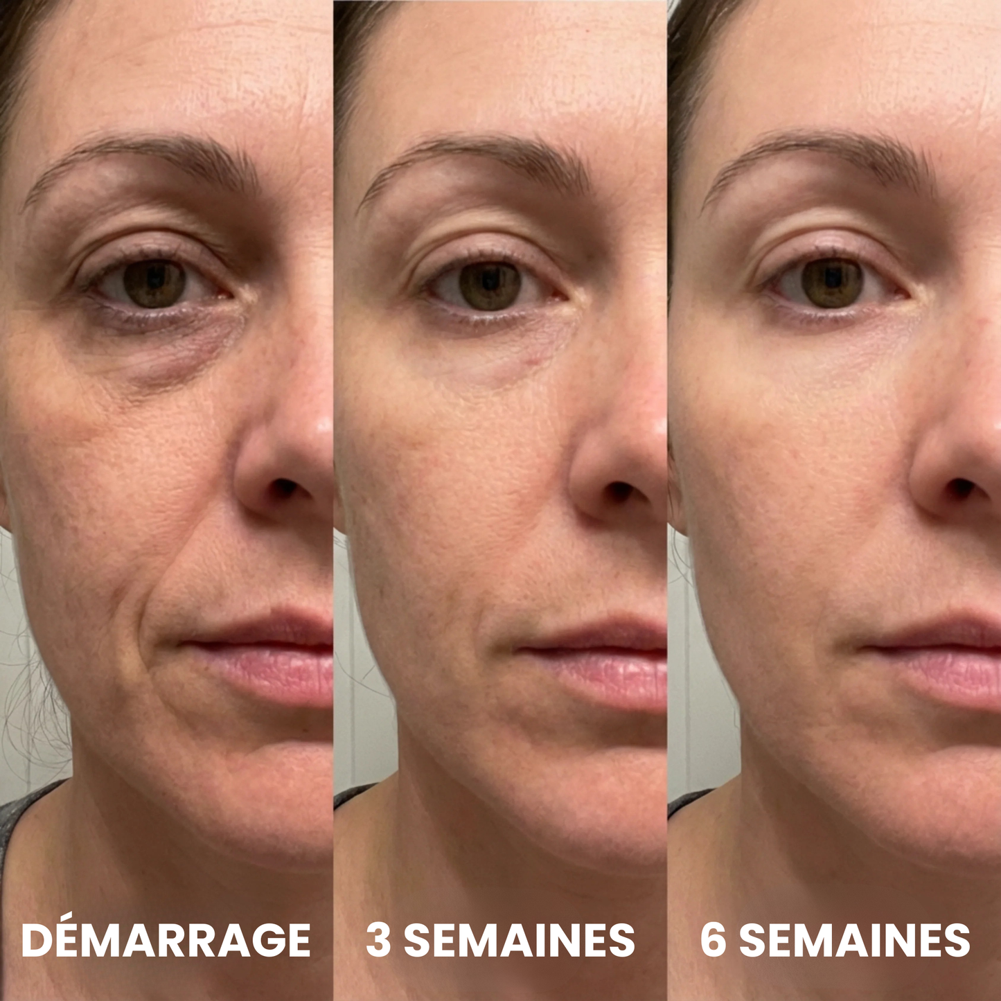 Résultats Sooya : démarrage, 3 semaines, 6 semaines